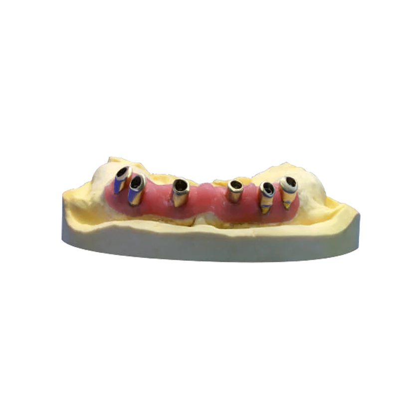 KKD TOPDENT OraMask - Zahnfleischmaskenmaterial